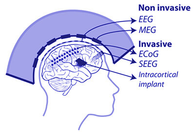 invasive-methods